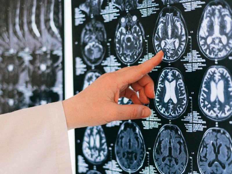 Double dissociations: Evidence for a modular organisation of cognitive&nbsp;processing