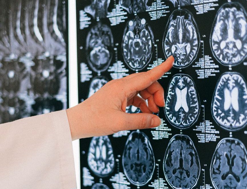 Double dissociations: Evidence for a modular organisation of cognitive&nbsp;processing